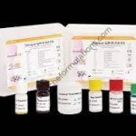 Chik Igm Elisa Kit