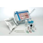 Toxo Igg Elisa Kit